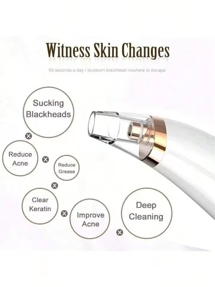 Instrumento de lavado, succión al vacío portátil, productos de belleza silenciosos, limpiador facial, eliminación profunda de acné y espinillas, fuerte succión 3